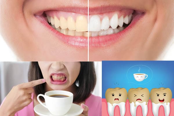 como quitar las manchas en los dientes