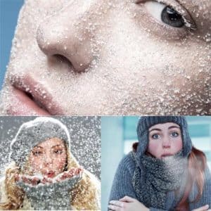 ?Como cuidar tu piel en el frio?