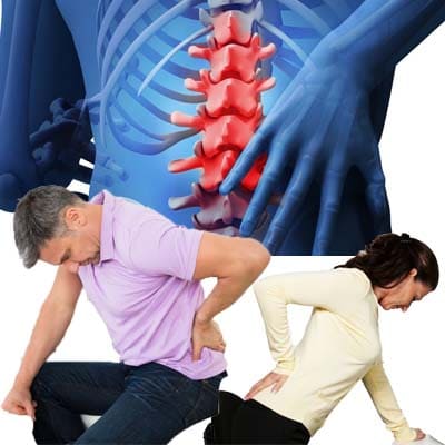 ¿Por qué se produce el dolor de espalda baja?